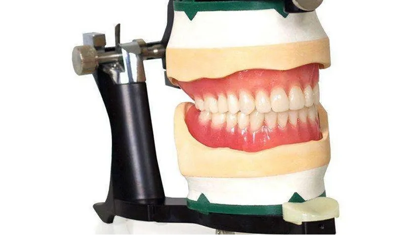 Điều trị gắn khớp