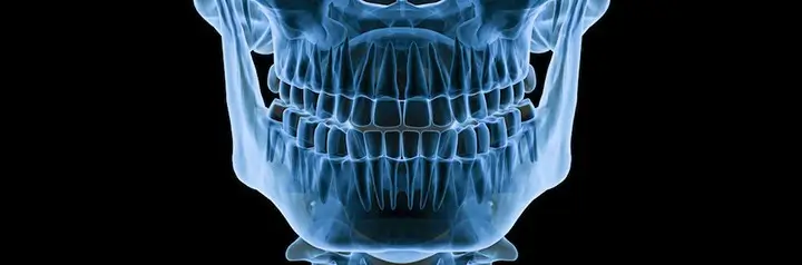 Điều trị đau khớp hàm